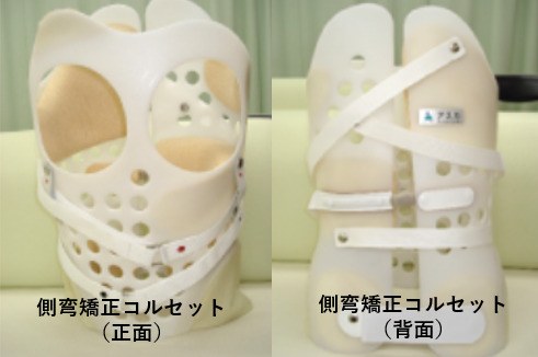側弯症矯正装具（コルセット）を装着することの利点とは？ シュロス側 