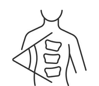 We accept consultations for scoliosis. Schroth Method Scoliosis Therapy