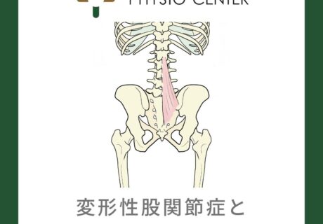 変形性股関節症と多裂筋の関係について