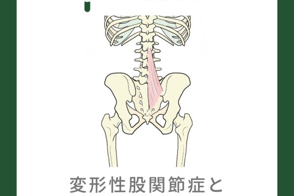 変形性股関節症と多裂筋の関係について