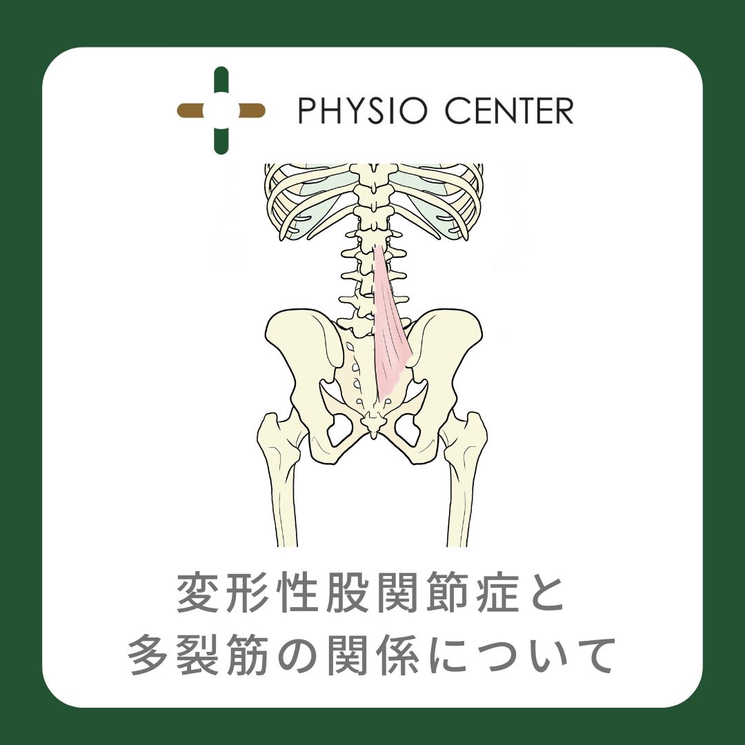 変形性股関節症と多裂筋の関係について