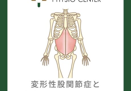 変形性股関節症と腹横筋の関係について