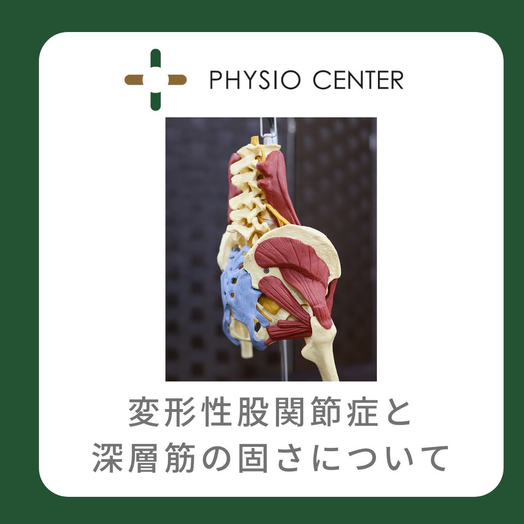 変形性股関節症と深層筋の固さについて