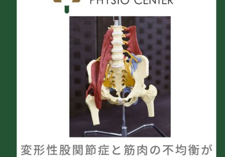 変形性股関節症と筋肉の不均衡が与える影響について