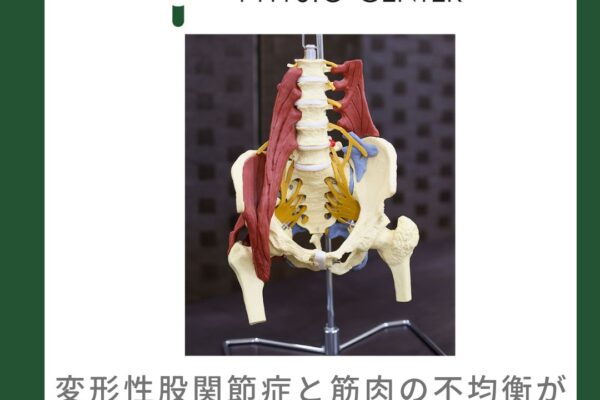 変形性股関節症と筋肉の不均衡が与える影響について