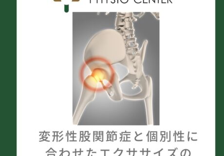 変形性股関節症と個別性に合わせたエクササイズの選択について