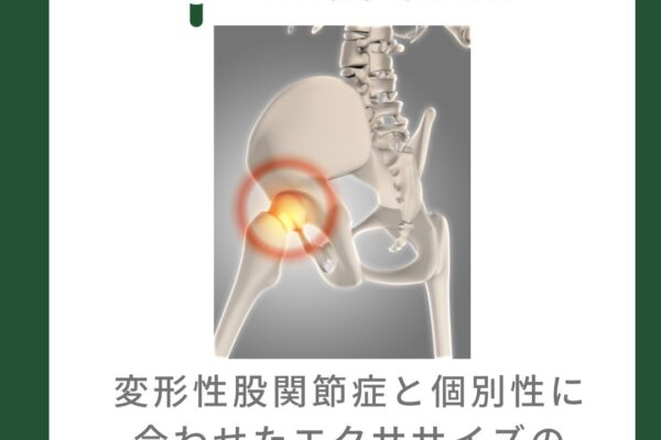 変形性股関節症と個別性に合わせたエクササイズの選択について