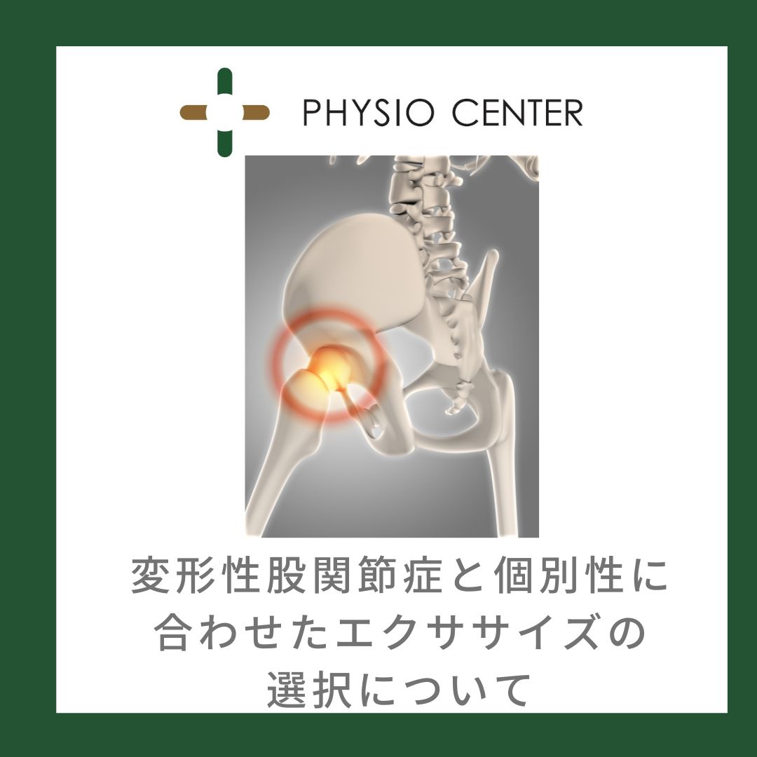 変形性股関節症と個別性に合わせたエクササイズの選択について