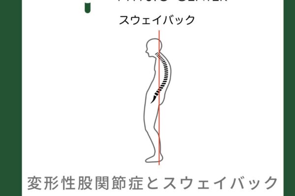 変形性股関節症とスウェイバック姿勢との関係について