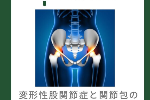 変形性股関節症と関節包の厚さとの関係について