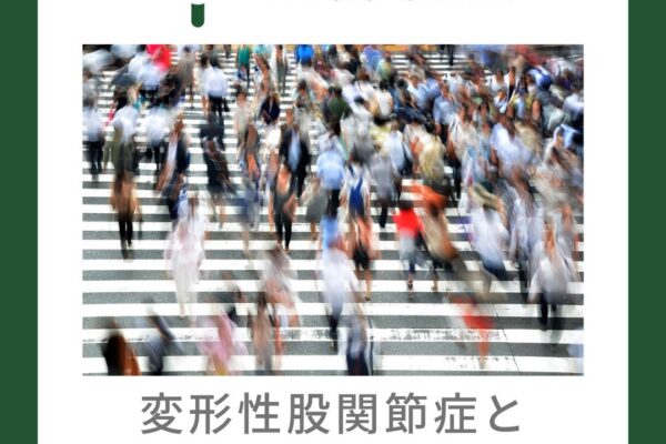 変形性股関節症と歩行速度の関係について