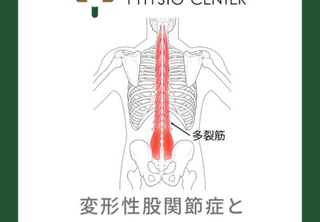 変形性股関節症と多裂筋の評価方法について