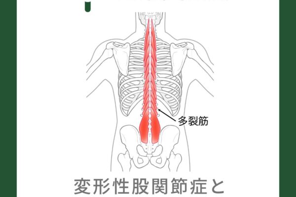 変形性股関節症と多裂筋の評価方法について