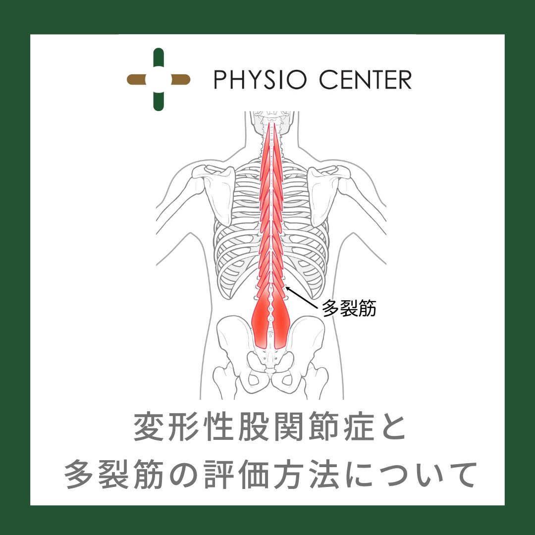 変形性股関節症と多裂筋の評価方法について