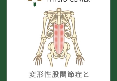 変形性股関節症と腹直筋との関係について