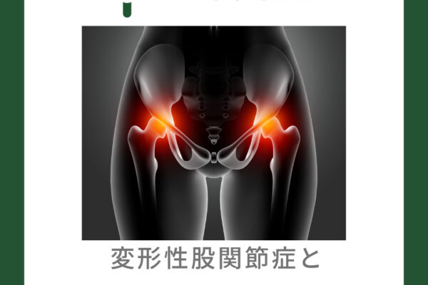 変形性股関節症と股関節の可動域制限について