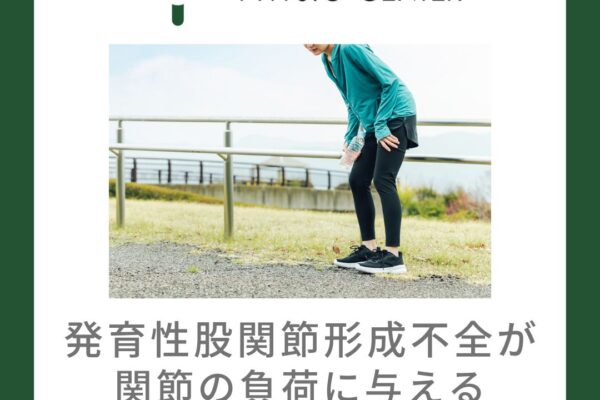 発育性股関節形成不全が関節の負荷に与える影響について