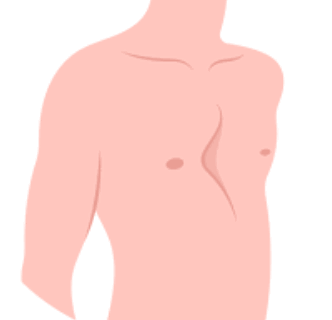 漏斗胸には、リハビリと体操療法が重要です。生活習慣の中で良い姿勢の意識付けも大切。