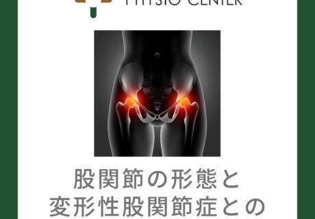 股関節の形態と変形性股関節症との関係について