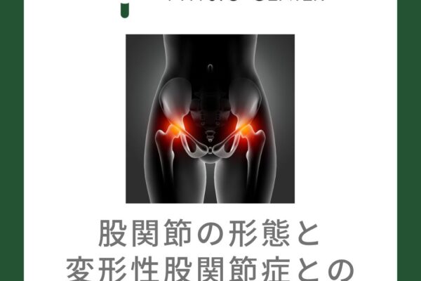 股関節の形態と変形性股関節症との関係について