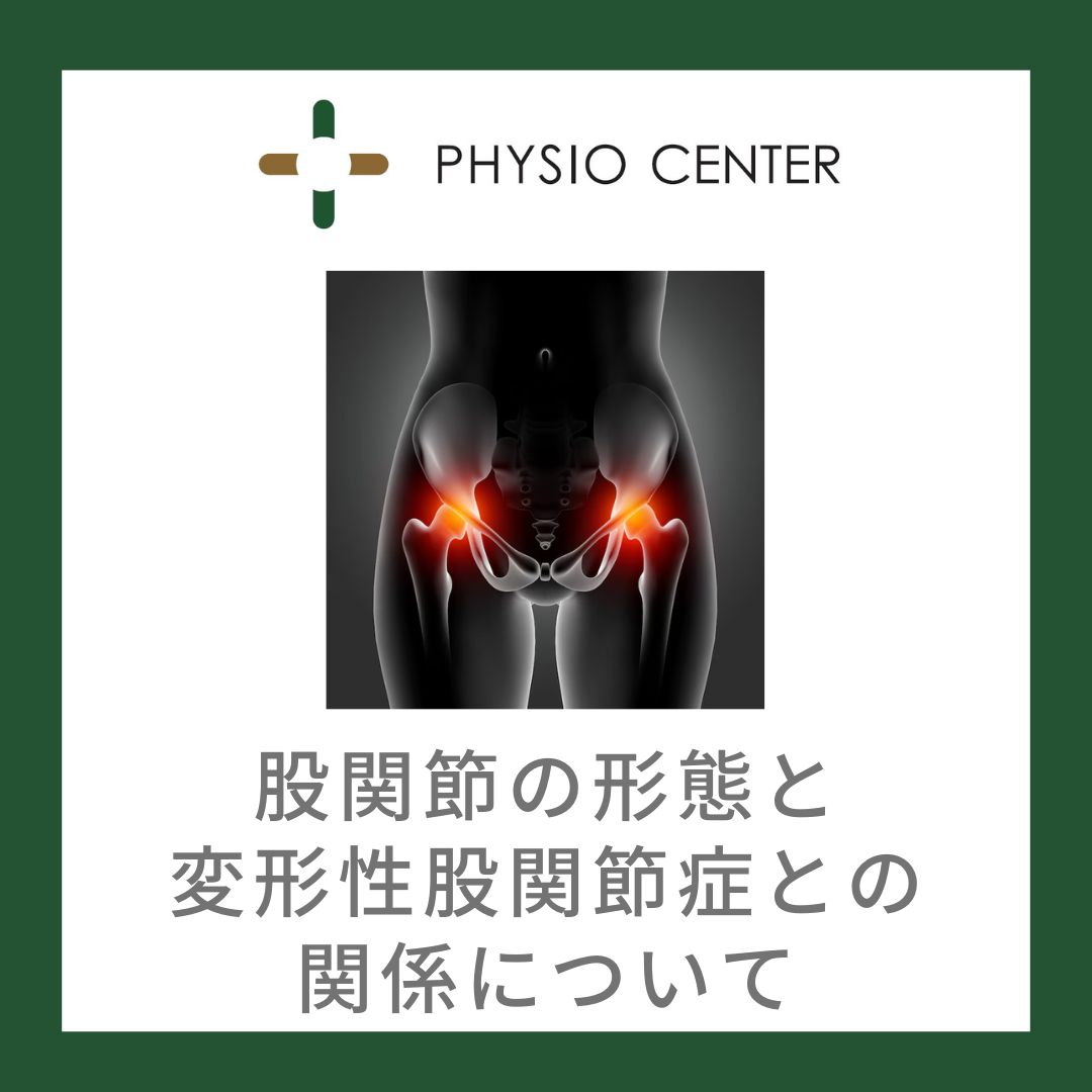 股関節の形態と変形性股関節症との関係について