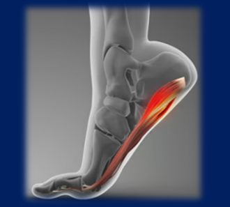 Traveling in Japan with Heel Pain? Don’t Let Plantar Fasciitis Ruin Your Journey.