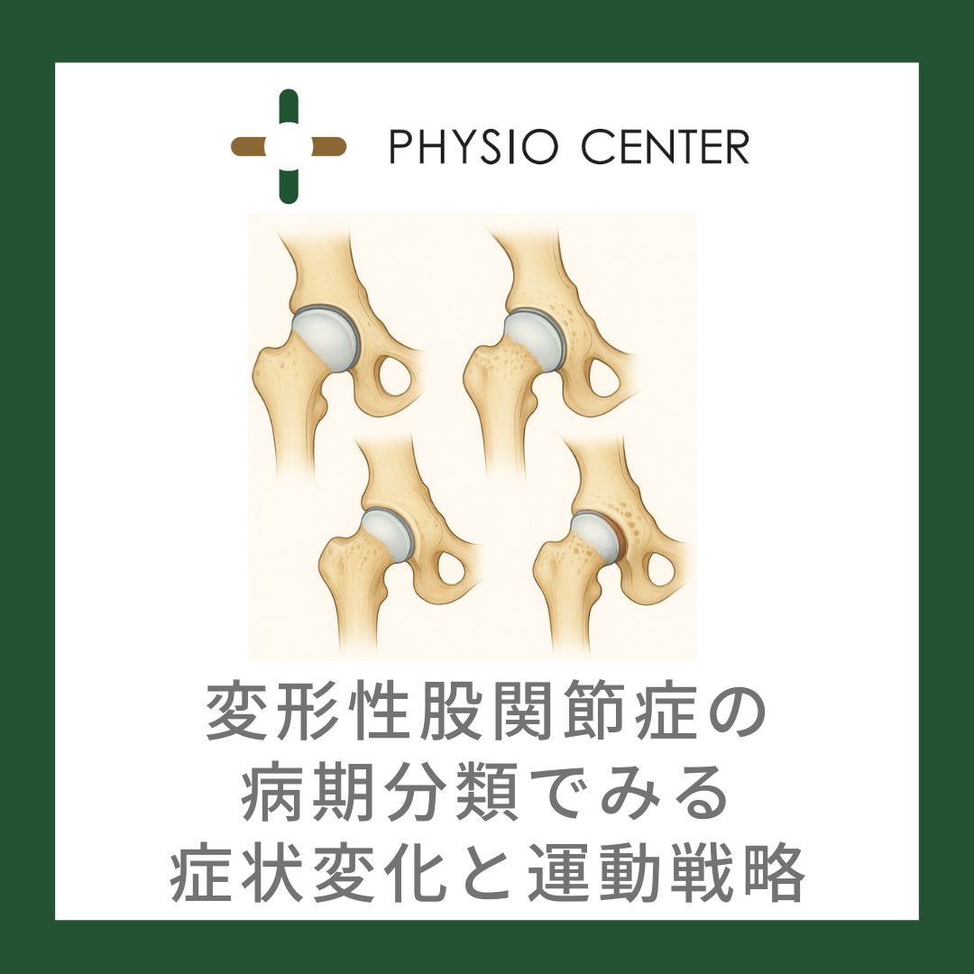 変形性股関節症の病期分類でみる症状変化と運動戦略