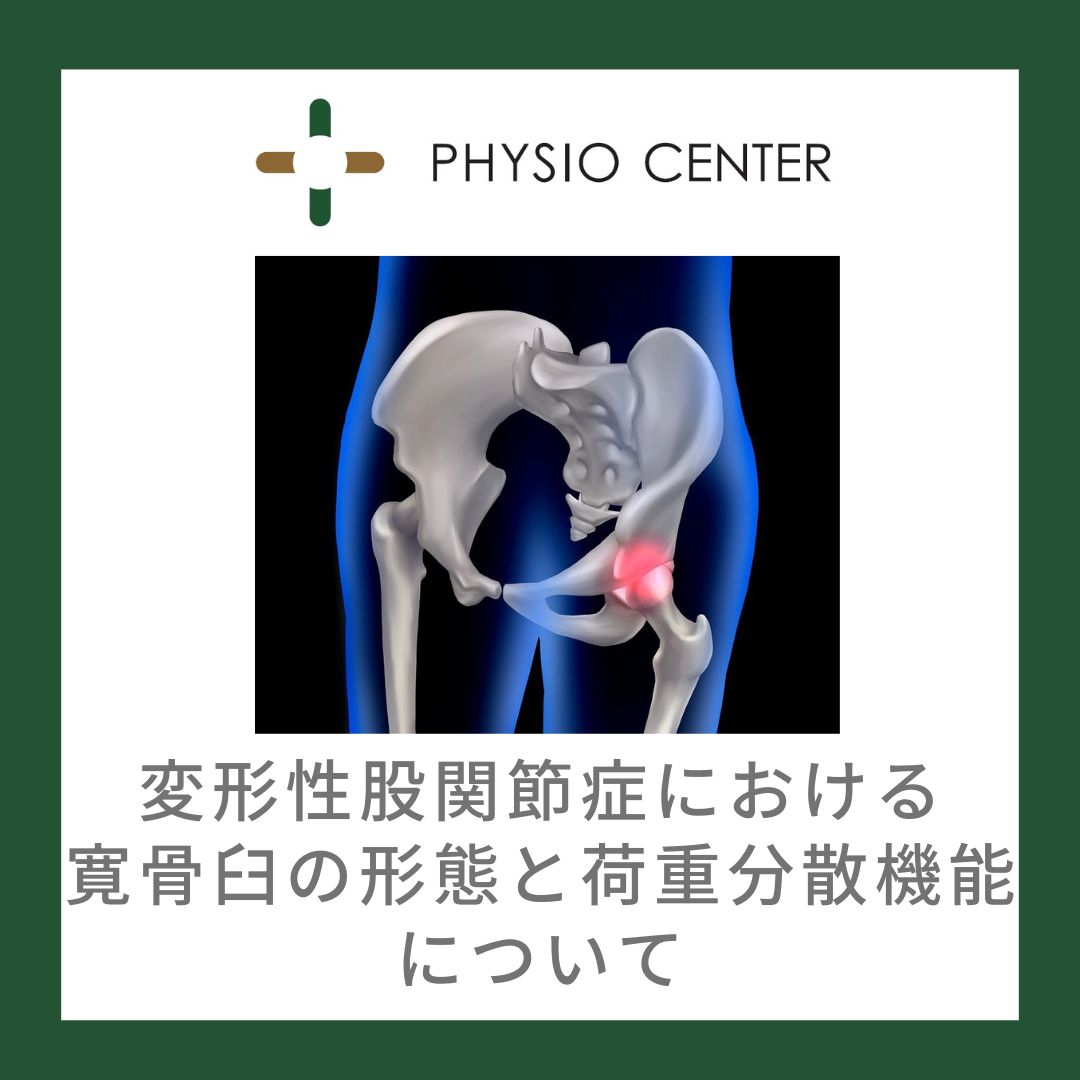 変形性股関節症における寛骨臼の形態と荷重分散機能