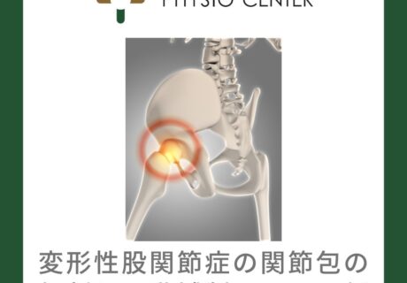 変形性股関節症の関節包の役割と可動域制限との関係