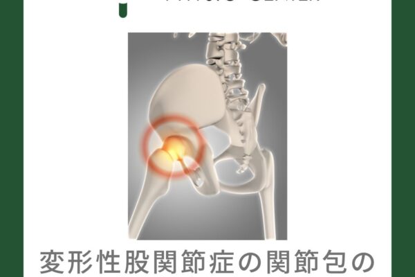 変形性股関節症の関節包の役割と可動域制限との関係