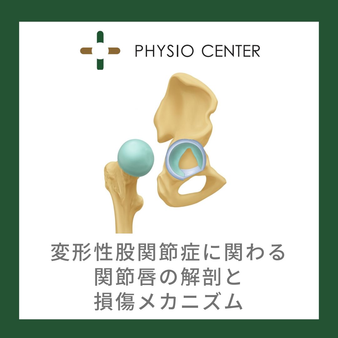 変形性股関節症に関わる関節唇の解剖と損傷メカニズム