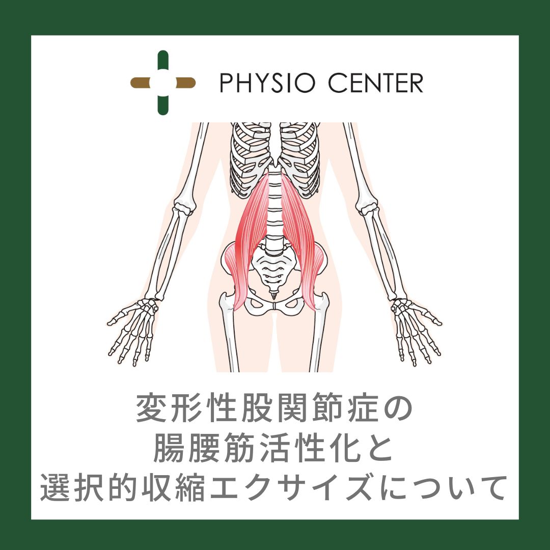 変形性股関節症の腸腰筋活性化と選択的収縮エクサイズについて