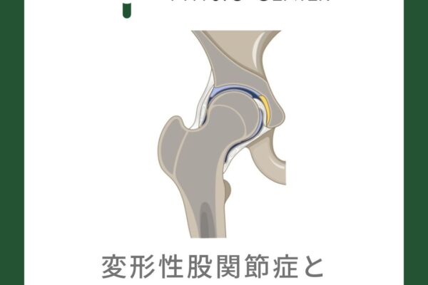 変形性股関節症と関節裂隙との関係について