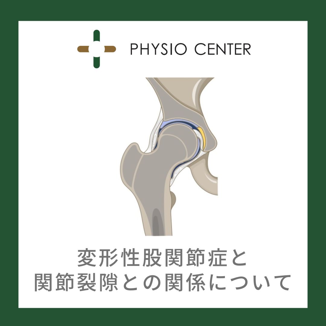 変形性股関節症と関節裂隙との関係について