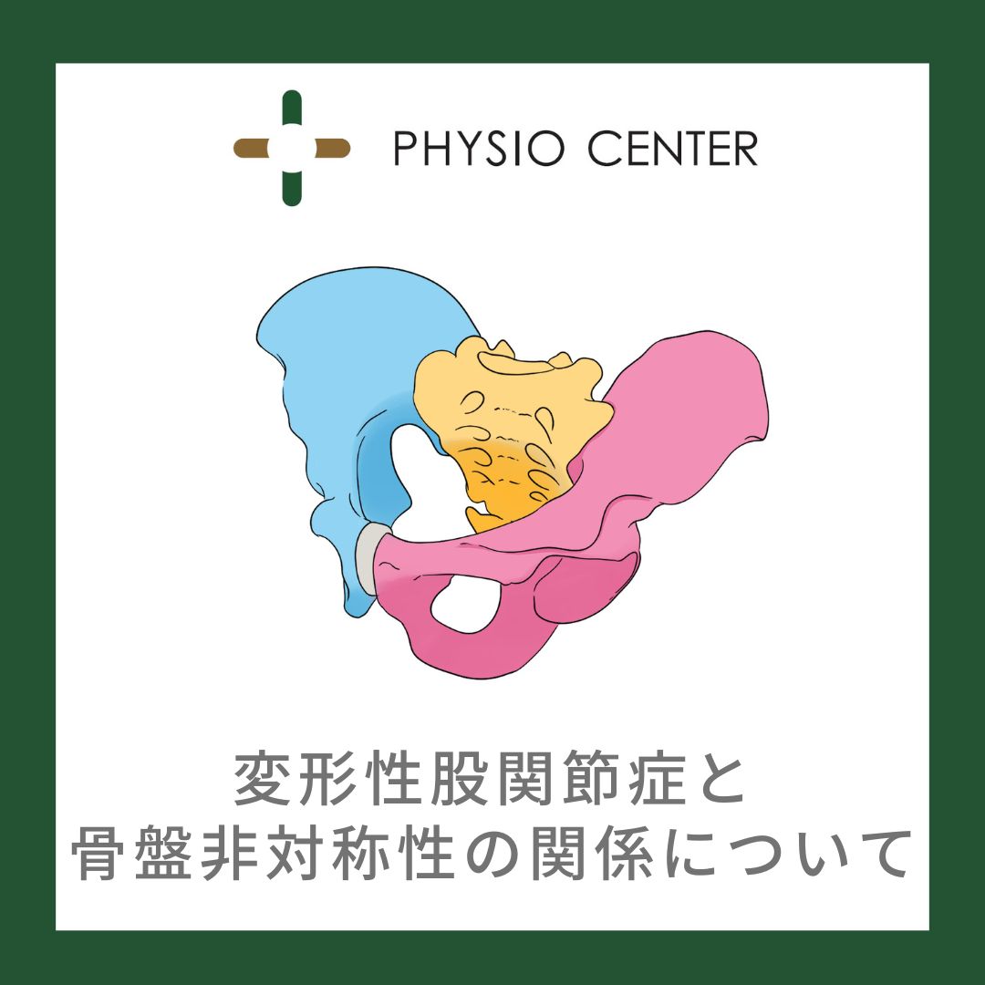 変形性股関節症と骨盤非対称性の関係について