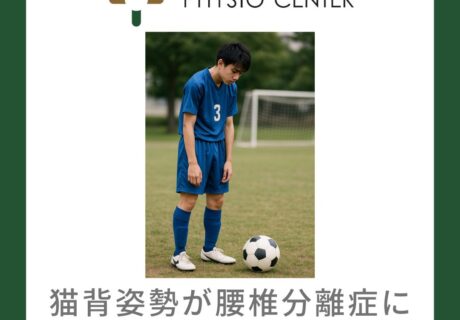 腰椎分離症と猫背との関係について