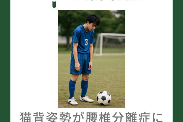 腰椎分離症と猫背との関係について