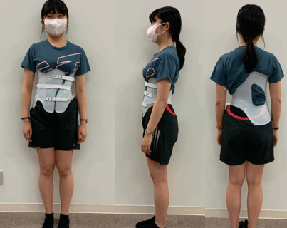 【側弯症治療に対する研究報告のご紹介】側弯症におけるボストン装具とシェノー装具の比較──同等の効果なら、より快適な選択を