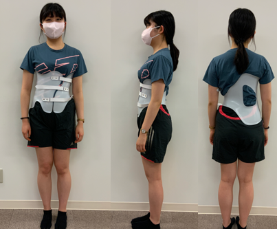 【側弯症治療に対する研究報告のご紹介】側弯症におけるボストン装具とシェノー装具の比較──同等の効果なら、より快適な選択を