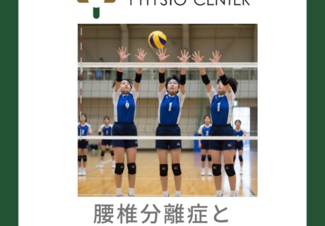 腰椎分離症と筋バランスの関連性