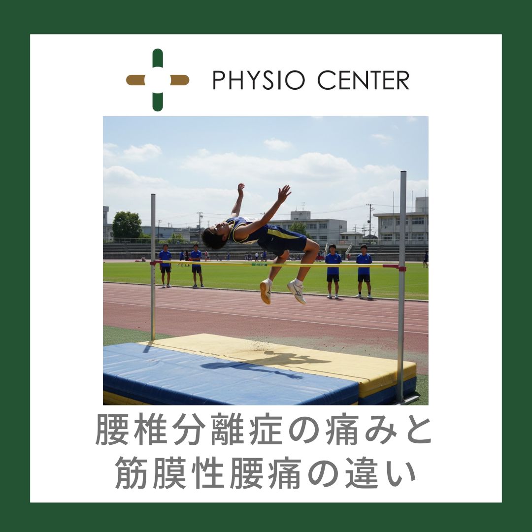 腰椎分離症の痛みと筋膜性腰痛の違い