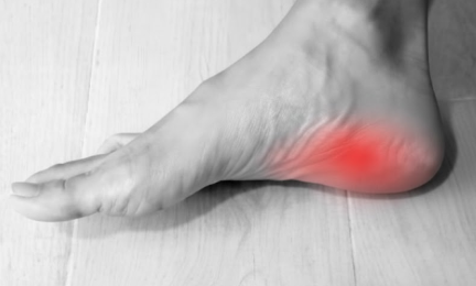 起床時の数歩が飛び上がるほど足裏が痛い！それは足底腱膜炎の症状では：　「正しく評価して直ぐに改善できます」　