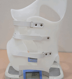 側弯症の矯正装具でお悩みのご両親へ　シェノー装具のご紹介　軽量で装着しやすく効果的な装具です。