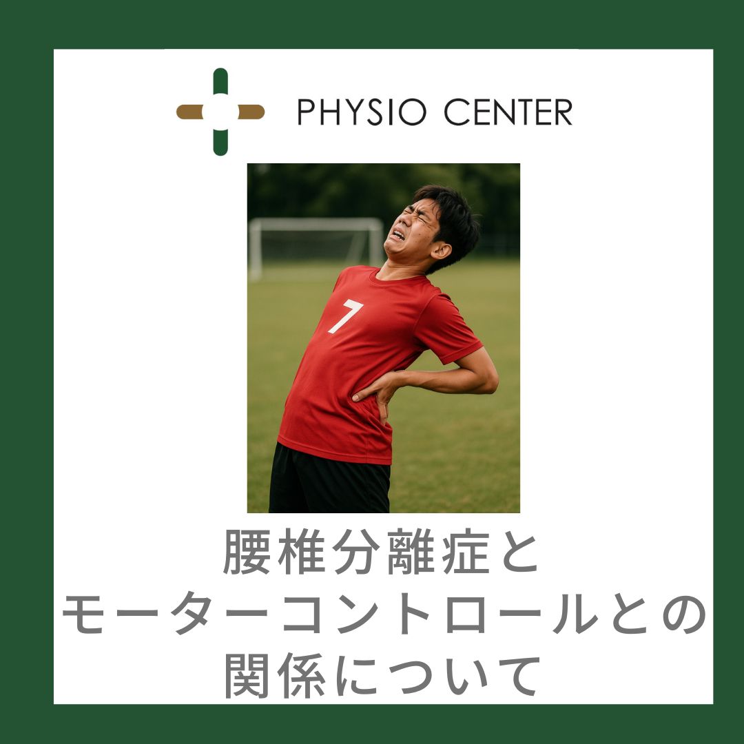 腰椎分離症とモーターコントロールとの関係について