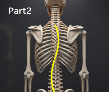 なぜ「経過観察」中に側弯体操を勧められないことがあるのか？ 分かりやすく解説　Part２　‐側弯症の体操は、一般的な運動とは別ものです‐　