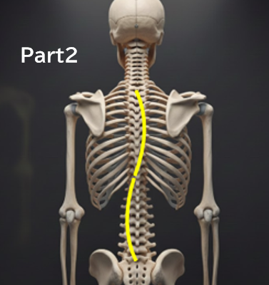 なぜ「経過観察」中に側弯体操を勧められないことがあるのか？ 分かりやすく解説　Part２　‐側弯症の体操は、一般的な運動とは別ものです‐　