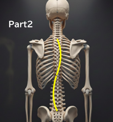 なぜ「経過観察」中に側弯体操を勧められないことがあるのか？ 分かりやすく解説　Part２　‐側弯症の体操は、一般的な運動とは別ものです‐　