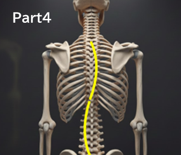 なぜ「経過観察」中に側弯体操を勧められないことがあるのか？分かりやすく解説Part４‐「勧められていない＝効果がない」という意味ではありません‐