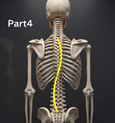 なぜ「経過観察」中に側弯体操を勧められないことがあるのか？分かりやすく解説Part４‐「勧められていない＝効果がない」という意味ではありません‐