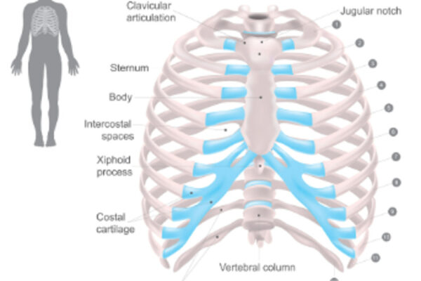 側弯症の脊柱固定術後における呼吸機能低下と胸郭アプローチの必要性